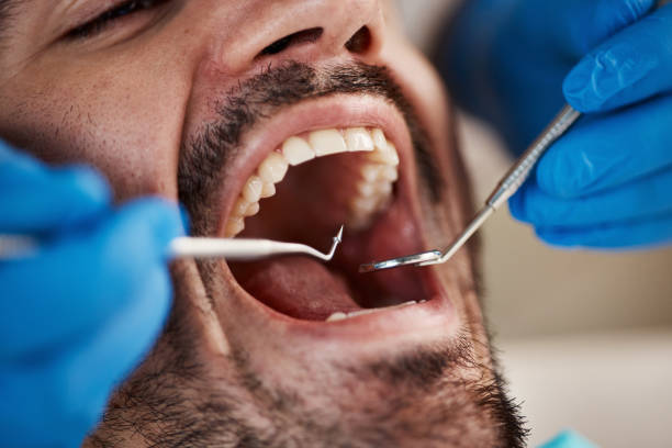 Best Urgent Tooth Repair  in Slater, IA